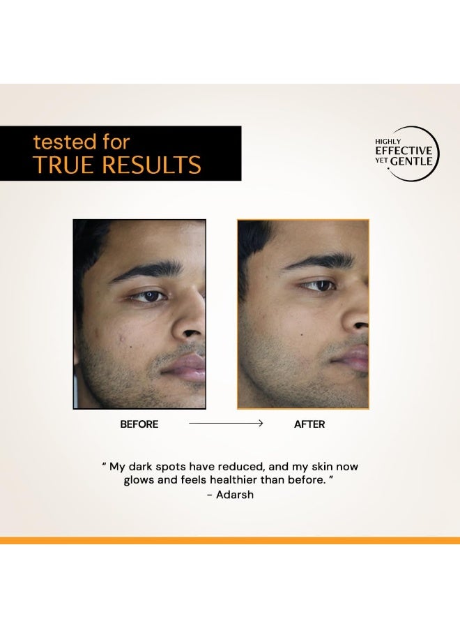 ديكونستركت سيروم فيتامين سي بتركيز 10% لبشرة متألقة | مُختَبَر سريريًا لعدم تسببه في تهيج البشرة | مناسب للمبتدئين | يُفتّح البشرة الباهتة ويوحّد لونها | للبشرة الدهنية | مع حمض الفيروليك | للرجال والنساء | 10 مل - Image 4